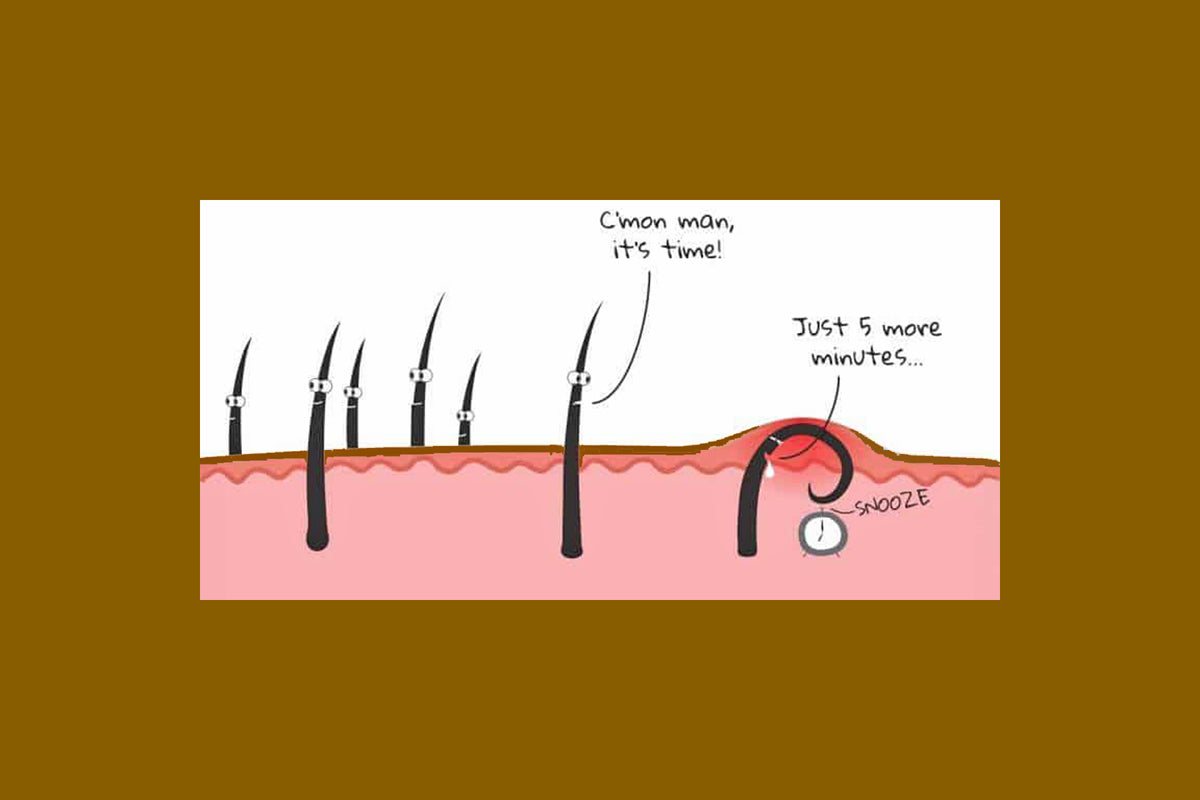 How to Prevent Shaving Bumps & Ingrown Hairs – Beauty Of The Nile